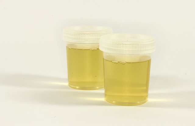 urine tests